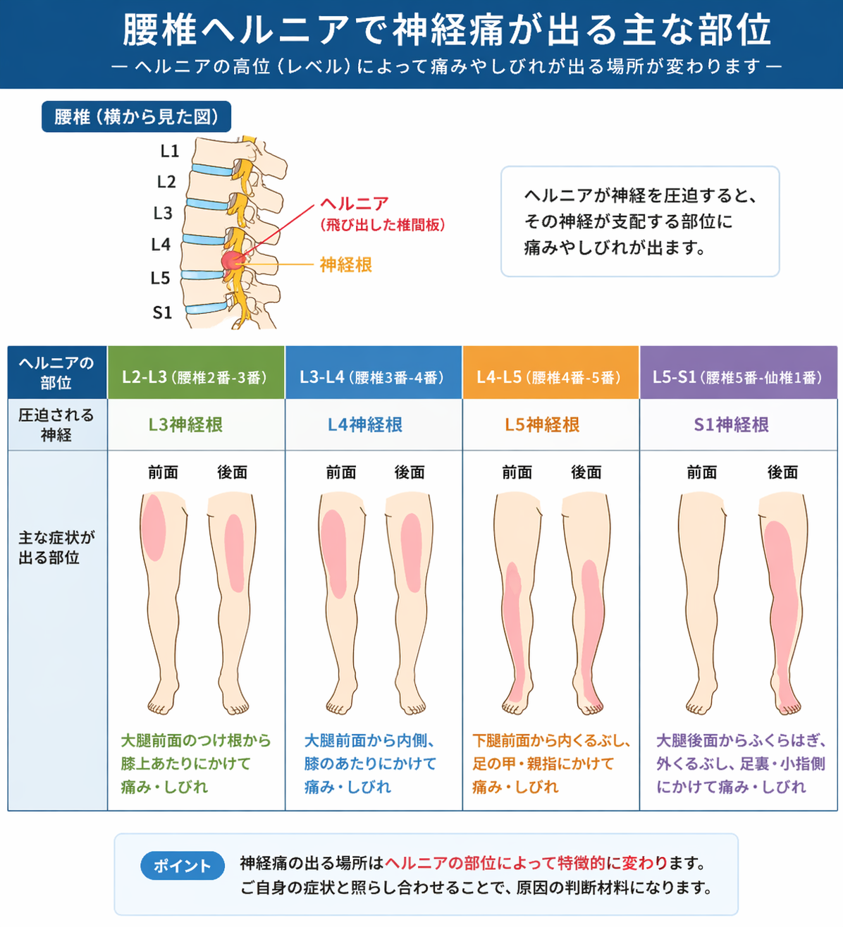腰椎の神経圧迫で下半身に症状が出る部位の図