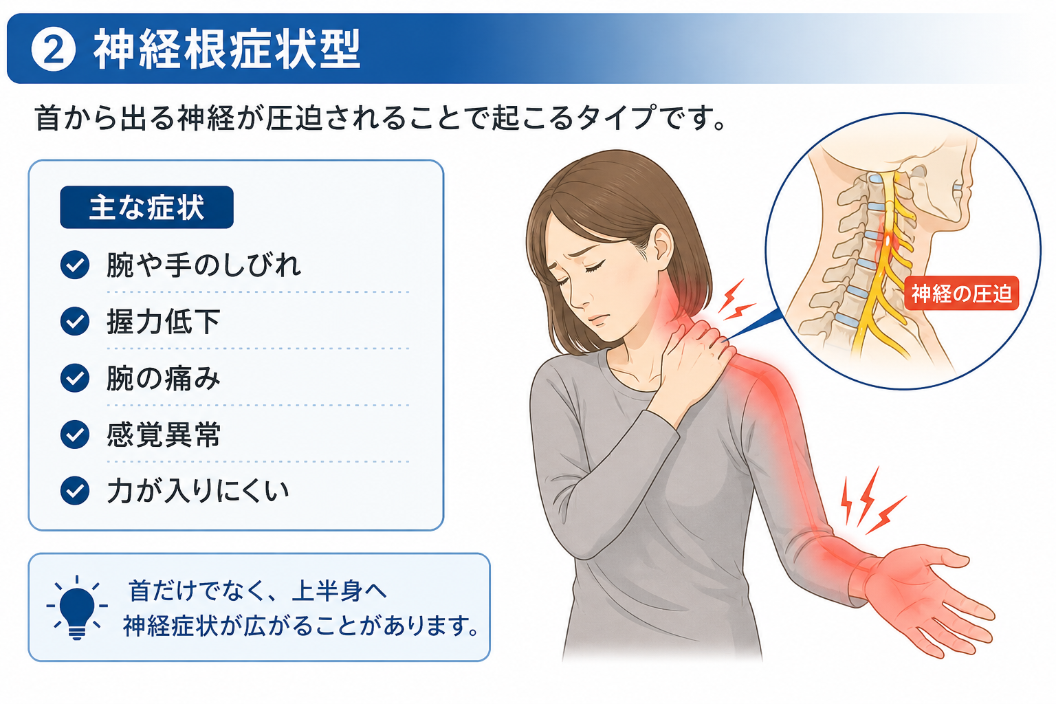 神経根症状型のむち打ち。首から出る神経が圧迫され、腕や手のしびれ、握力低下、腕の痛み、感覚異常、力が入りにくい症状が出ることがあります。