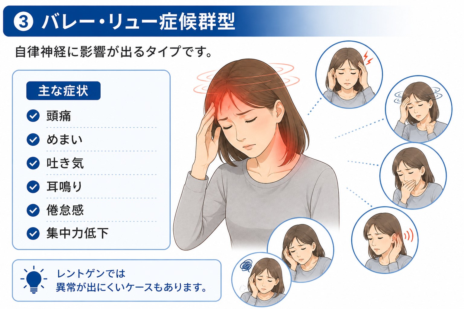 バレリュー症候群型のむち打ち。頭痛、めまい、耳鳴りなど自律神経症状が出るタイプの説明画像