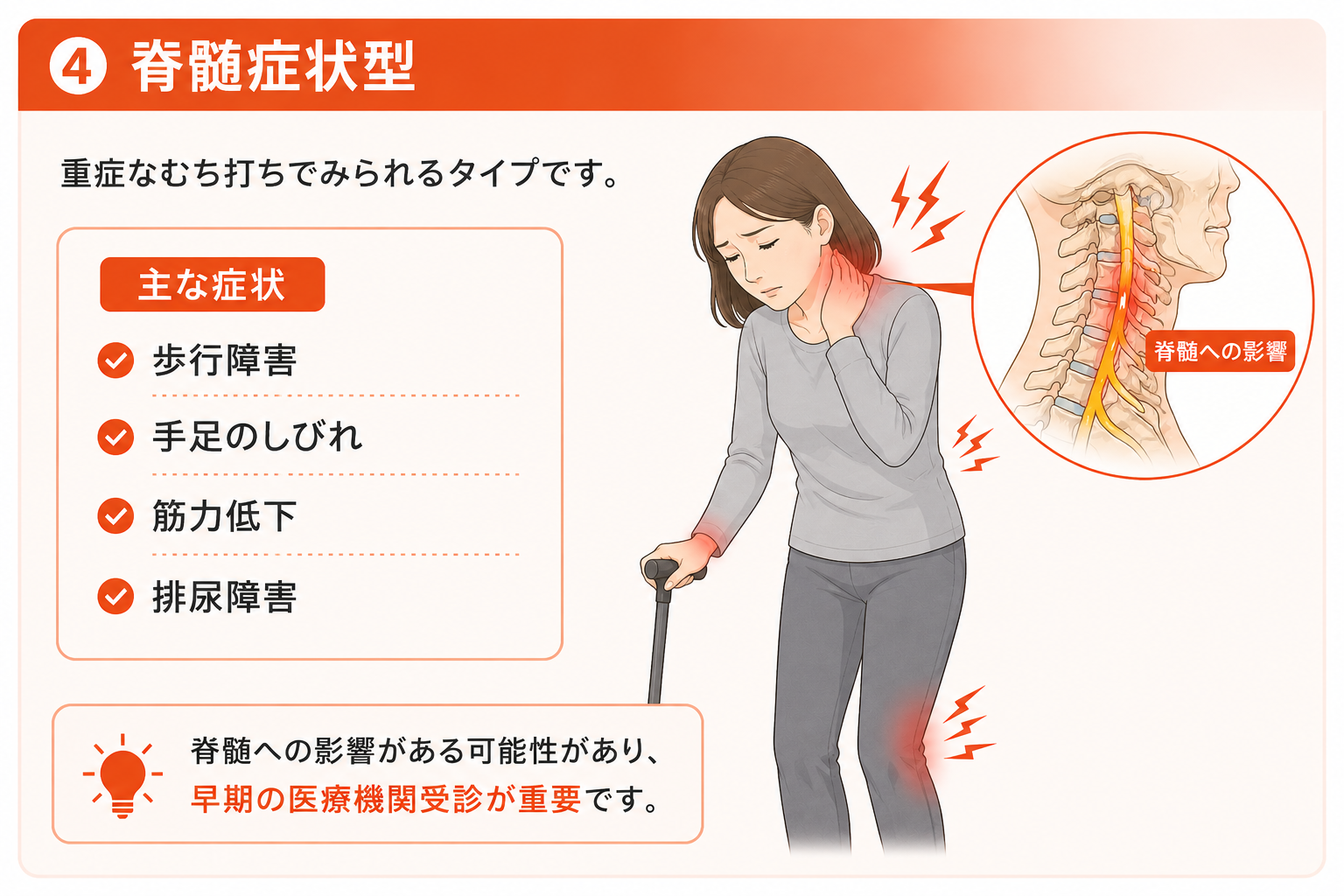 脊髄症状型のむち打ち。歩行障害や手足のしびれ、筋力低下など重症な症状が出るタイプの説明画像